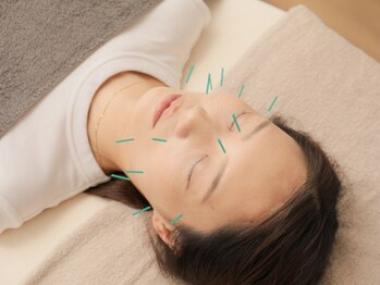 Onはり灸サロンの写真/丁寧なカウンセリングと美容鍼で、大人女性が気になるフェイスラインをスッキリ綺麗に!お気軽にご来店を*