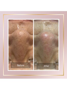 リシェス(Richesse)/エクストラクション☆初回¥9990