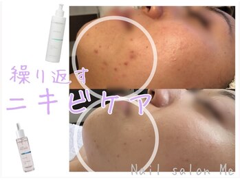 ミー(Me)/《肌質改善》