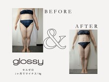 グロッシー(glossy)/痩身最強のセルライトゼロ導入店