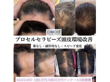 マハロ メンズ脱毛(MAHARO)の雰囲気（頭皮環境改善で髪の悩みをおわらせる。）