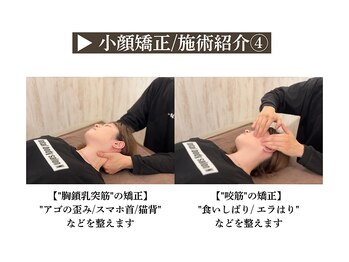 カラダコンシェルジュN(KARADAコンシェルジュN)/【小顔矯正】施術シーン紹介４