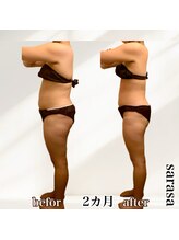 ナチュラル ビューティー スタイル さらさ(Natural Beauty Style)/さらさ痩身プログラム2カ月