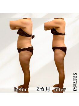 ナチュラル ビューティー スタイル さらさ(Natural Beauty Style)/さらさ痩身プログラム2カ月