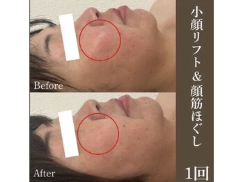 サロンドペシェ(salon de peche)/EMS小顔リフト顔筋ほぐしコース