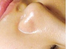 Beaute de ACRI 元町店【フェイシャル/痩身/筋膜リリース/小顔】/【美肌実感コース】