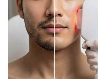 ビカム(become)の写真/《脱毛×肌荒れケア》刺激の少ない脱毛で面倒な毛の処理から卒業☆更に肌荒れケアも叶う♪清潔感もUP◎