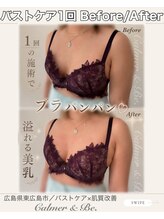 カルマーアンドビー(Calmer & Be.)/【バストケア】Before/After