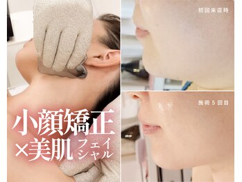 ハーボプラス(THE HEARBO plus)の写真/人気No.1【たるみ/二重あご/ほうれい線】小顔矯正×美肌フェイシャル90分9900円　