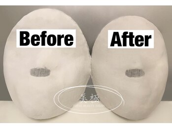 美極 トータルビューティー(美極 TOTAL BEAUTY)/恵比寿/小顔コルギ/エステ/