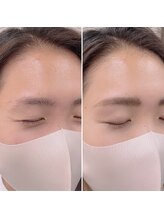 ブラッシュ バイ オトナ 相模原(BRUSH by 0107)/眉毛が生えてきません！/相模原