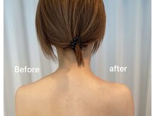 スリビア(SLIVIA)/華奢見え肩☆ビフォーアフター