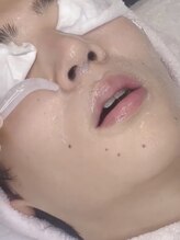 ロンハナ(lonhana)