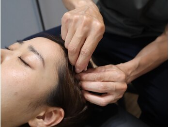 リコンディショニング 自由が丘(Reconditioning)/■鍼灸施術/頭■