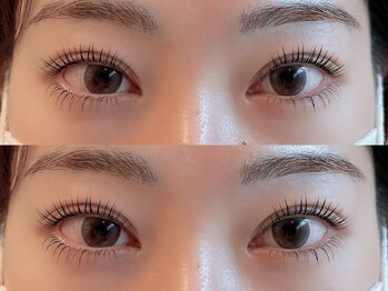 ユーロ(EURO)/上下のラッシュリフト