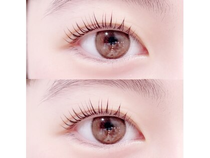 クリア アイ 茶臼山店(Clear eyes)の写真