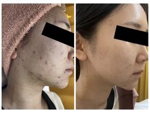 パールプラス 桑名店(Pearl plus)/before / after