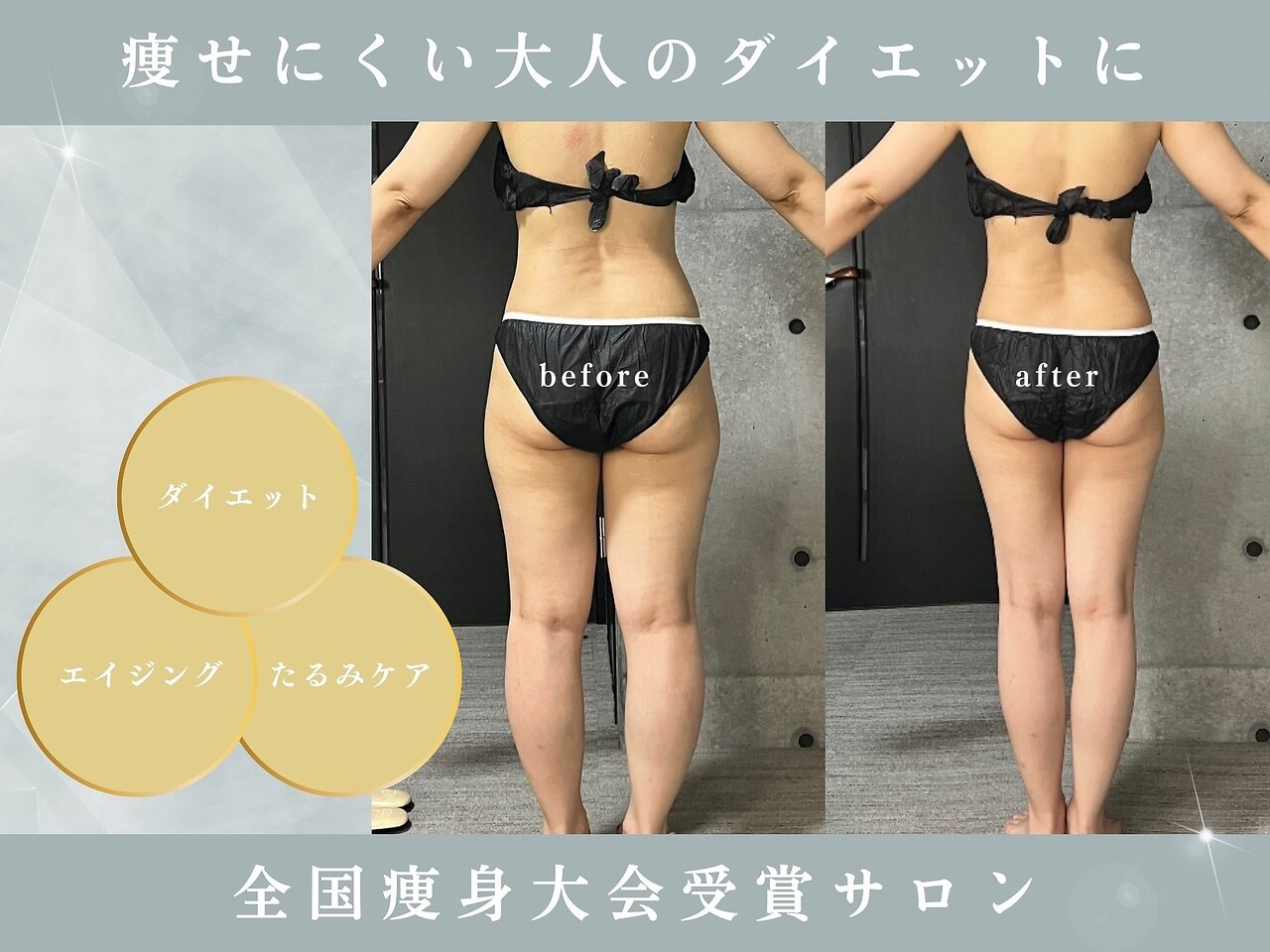 痩身】新機種caviZEROⓇ＋RF 特許申請済みの「Wキャビテーション