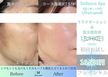 ディアスマイル(Dear.smile)