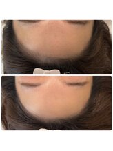 アプロディタ/骨格に合わせて可愛い輪郭提案