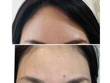 ドルチェビューティーサロン 戸塚安行店(Dolce Beauty Salon)/ダクトピール