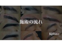 ケープラス(K Plus+)/施術の流れ