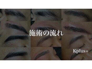 ケープラス(K Plus+)/施術の流れ
