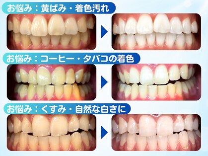 LBSホワイトニング 吉祥寺店の写真