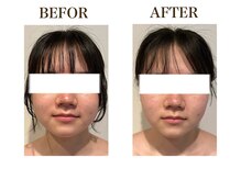 ルアバイアロ(Lua by Alo's)/顔のむくみケア