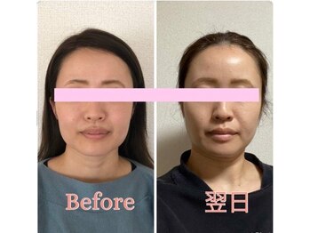 エール(aile)/エラハリ気になる方必見