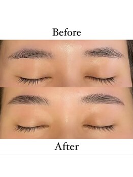 グランツ(GLANZ)/ハリウッドブロウリフト