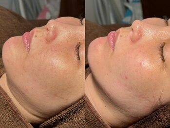 ルーナジェーナ(Luna llena)/池袋 エステ ルーナジェーナ