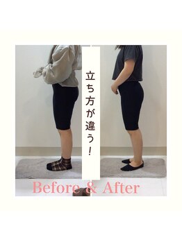 スタイルラボ高松/産後骨盤矯正の効果♪