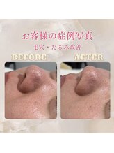 パンジー 上野フェイシャルエステ専門店(pansy)/*フェイシャル/たるみ毛穴ケア*