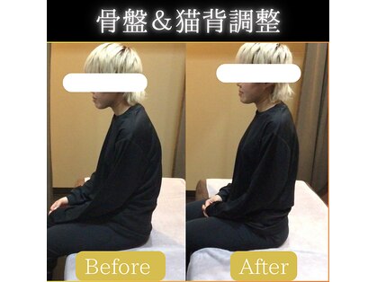 マクシル(MAXIL)の写真