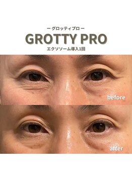 フルアナ(Hu ruana)/フェイシャルエステ