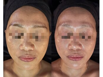 侘寂(wabisabi)/症例写真