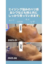 ジュネラ ボーテ(Jenela beaute)/ツヤハリ変化