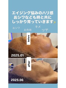 ジュネラ ボーテ(Jenela beaute)/ツヤハリ変化