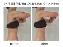 ナチュラーレ 天王寺店(Naturale)/痩身リンパマッサージ二の腕美脚