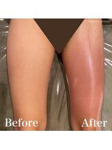 モット 神戸店(Motto)/脚全体痩身