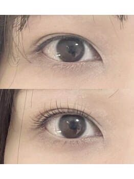 abp /ラッシュリフト