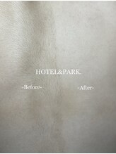 ホテルアンドパーク(HOTEL&PARK.)/お背中ALLワックス脱毛