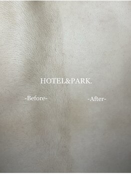 ホテルアンドパーク(HOTEL&PARK.)/お背中ALLワックス脱毛