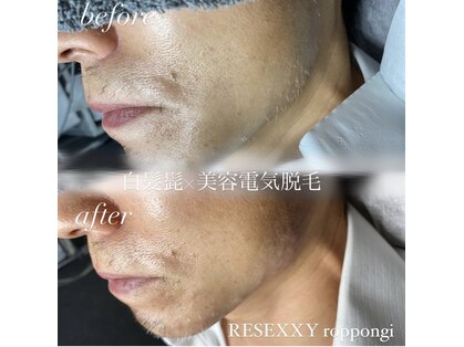 リゼクシー INTERNATIONAL麻布十番 六本木(RESEXXY)の写真