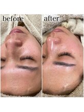 モンクラッシー(Mon classy)/1度の変化