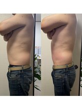 ティグレ 岡山店(TIGRE)/痩身エステ（上半身）１回