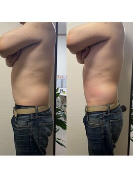 ティグレ 岡山店(TIGRE)/痩身エステ(上半身)1回