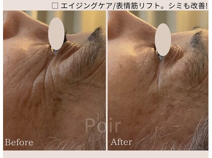 ポ ワール(Poir)の写真