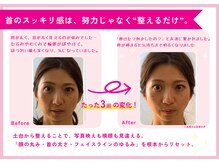 理想の小顔 福島店/即効性がある！必ず効果が出る！